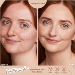 ColourPop Hyaluronic Hydrating Foundation in Fair 20 N evens skin tone on a model's face in an unretouched before-and-after, side-by-side studio close-up showing reduced redness and a natural finish; Pretty Fresh, vegan, hyaluronic acid, dermatologist tested.