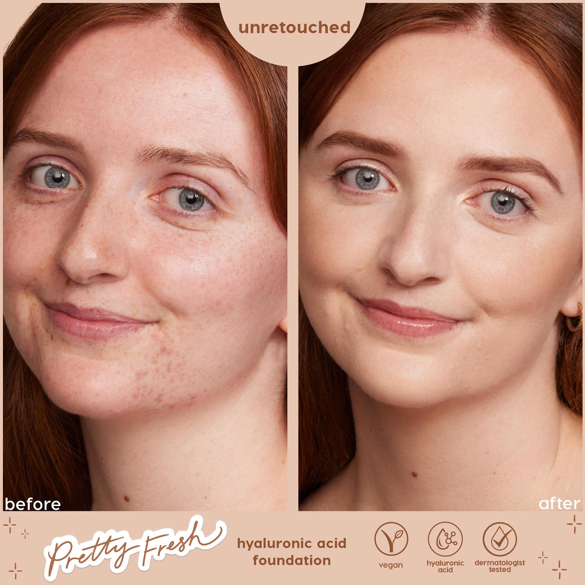 ColourPop Hyaluronic Hydrating Foundation in Fair 20 N evens skin tone on a model's face in an unretouched before-and-after, side-by-side studio close-up showing reduced redness and a natural finish; Pretty Fresh, vegan, hyaluronic acid, dermatologist tested.
