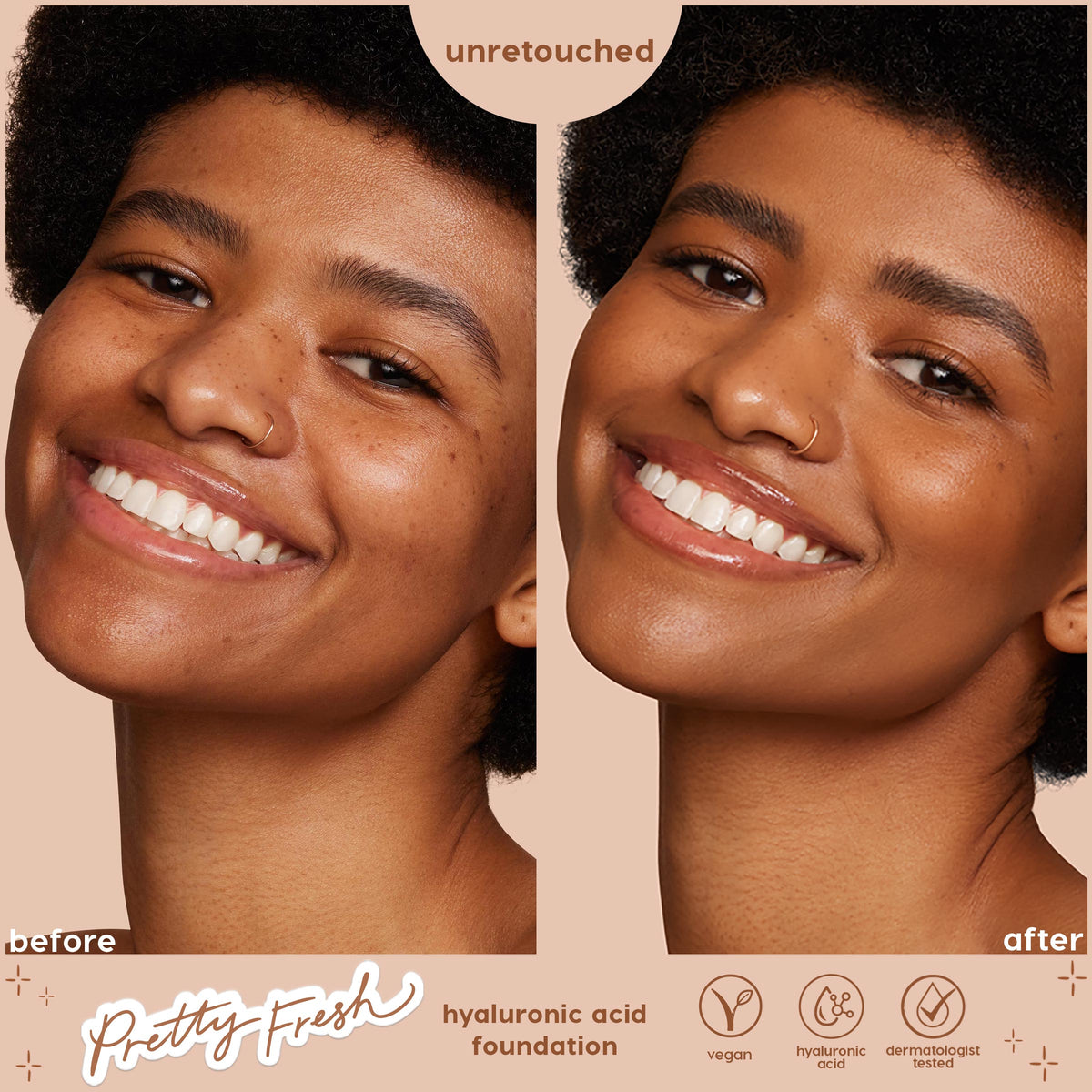 Smiling model displays side-by-side before and after of ColourPop Hyaluronic Hydrating Foundation, shade Medium Dark 147 W, showing a smoother, more even medium-dark complexion; unretouched, vegan, hyaluronic acid, dermatologist tested.